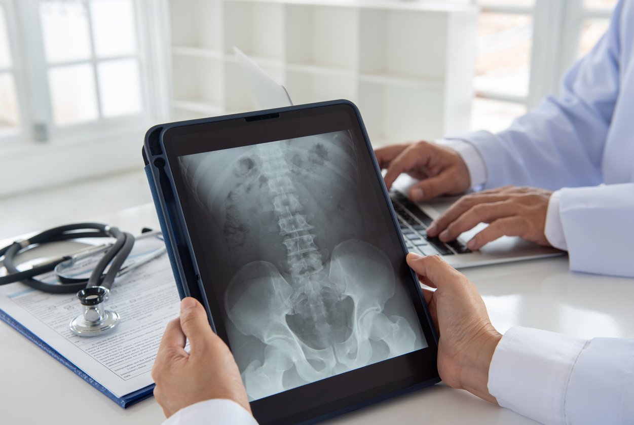 Woodland Hills Spinal Cord Injury Lawyer